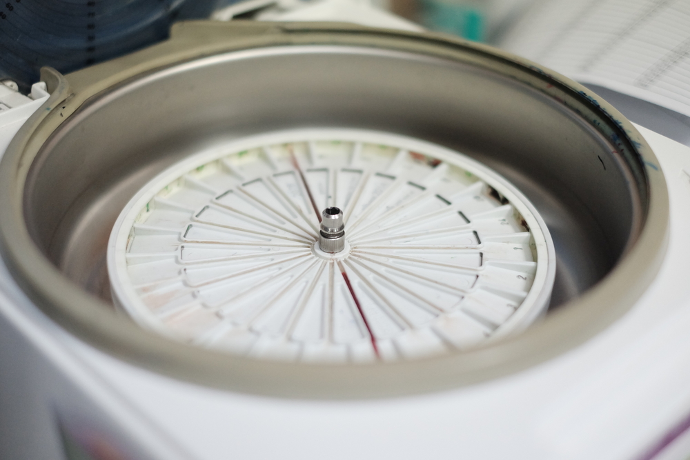 Renting vs. Buying a Centrifuge: Why Fall Projects Might Benefit More from Rentals